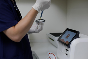 자동 수의학 생화학 면역분석기 전해질 혈액가스 분석기 혈액가스 분석기 가격 - Product Image 2