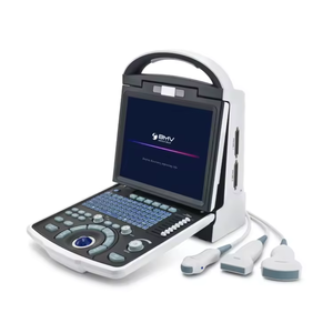 Escáner de <span class=keywords><strong>ecocardiograma</strong></span> cardíaco portátil mejor calificado Sistema de ultrasonido <span class=keywords><strong>Doppler</strong></span> a color digital completo - Product Image 4
