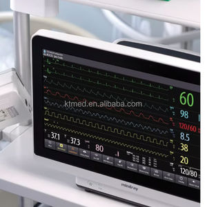 Moniteur multiparamètres Mindray BeneVision N17/N15/N12, moniteur patient vétérinaire Mindray, moniteur patient pour chirurgie et soins intensifs - Product Image 3