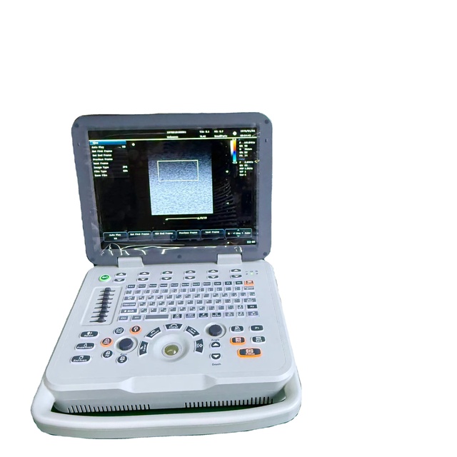 UMY UMYCU001 China Easy Scan Portable Metal Veterinary Ultrasound Machine with 1 Year Warranty