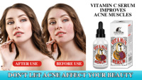 Sérum à la vitamine C ROUSHUN, éclaircissant, réparateur, hydratant, anti-taches, soin de la peau du visage