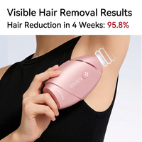 MLAY T22 Alat Penghilang Bulu Permanen Tanpa Rasa Sakit untuk Penggunaan di Rumah, Perangkat IPL Laser Penghilang Bulu untuk Wanita, Bikini, Kaki, dan Tubuh