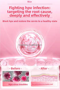 Professionelles Bioaktives Protein-Gel für Frauen zur <span class=keywords><strong>HPV</strong></span>-Behandlung zur Reduzierung des Viralbelasts & Unterstützung der Gebärmutterhals-Regeneration - Product Image 5