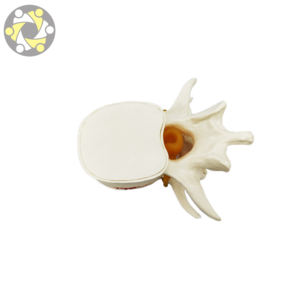 Sains medis Lumbar Disc Herniation Simulator tulang belakang Vertebral Model - Product Image 5