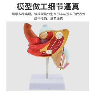 Muestras de simulación para la enseñanza de los órganos reproductores masculinos y el sistema urinario, genitales internos y externos, testículos - Product Image 3