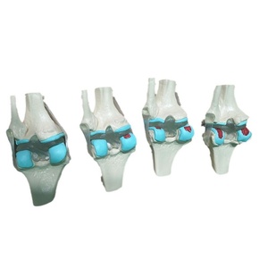 Material Didáctico Médico: Comparación de Patrones Normales y Patológicos para la Comunicación Médico-Paciente, Anatomía de la Articulación del Rodilla Humana - Product Image 2