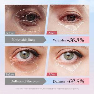 Crème Contour des <span class=keywords><strong>Yeux</strong></span> <span class=keywords><strong>Roll</strong></span>-<span class=keywords><strong>On</strong></span> SADOER à la Nicotinamide Effet Raffermissant & Nourrissant, Répare les Cernes, Élimine Instantanément les Poches sous les <span class=keywords><strong>Yeux</strong></span> (Marque Privée) - Product Image 3