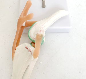 Hunde kniegelenk modell Stadien des Osteoporose modells für Hunde - Product Image 5