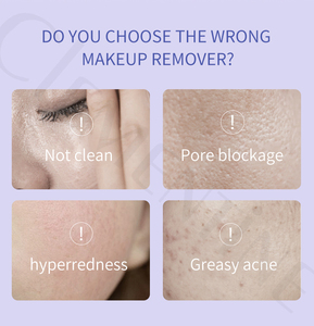 Vegan & tàn ác-miễn phí Aloe Sữa rửa mặt trang điểm Remover lỏng micelles làm sạch nước cho mắt, môi & khuôn mặt trang điểm - Product Image 4