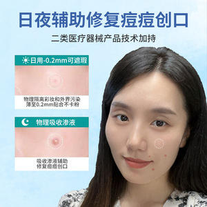 Acne patches use <b>physical</b> absorption to create artificial skin-like medical-grade hydrocolloid patches. They are as thin as - Product Image 4
