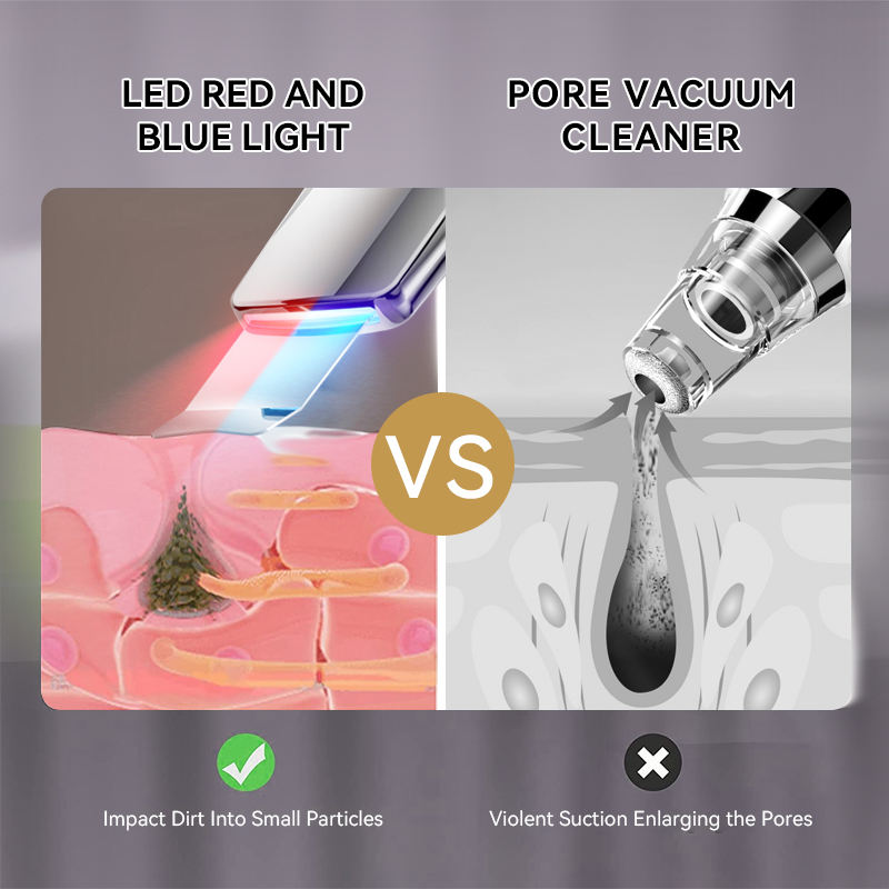 ORANGLES Ultrasonic Skin Scrubber Spatula | Deep Face Cleaning & Blackhead Remover Device | USB Rechargeable Home Beauty Equipment – orangles Kuwait - elegant presentation - exhibiting components - Image 6 of 6 | ideal for home | Discount on Ultrasonic Skin Scrubber Spatula | Deep Face Cleaning & Blackhead Remover Device | USB Rechargeable Home Beauty Equipment – orangles Kuwait Virginia | Free Shipping ORANGLES