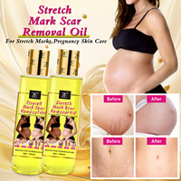 Minyak Pijat Anti-Kerut Pengencang Perawatan Wanita Hamil 150ml