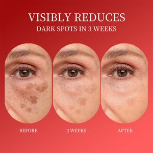 Nicotinamide เซรั่มน้ำมันช่วยให้ผิวกระจ่างใสช่วยลดริ้วรอยป้องกันริ้วรอยต่อต้านริ้วรอย - Product Image 5