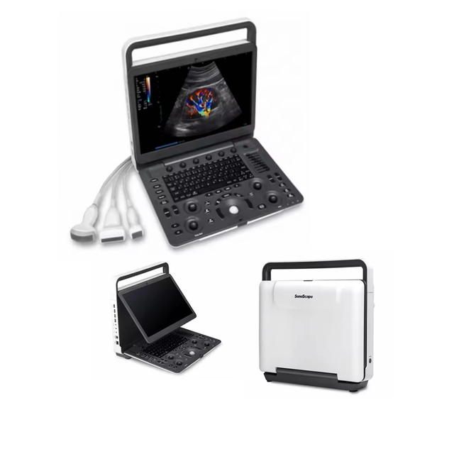 Sonoscape E1 E2 E2V Ultrasound Equipment for Tissue-Specific Portable Doppler Ultrasound Scanner with Auto IMT and SR Flow