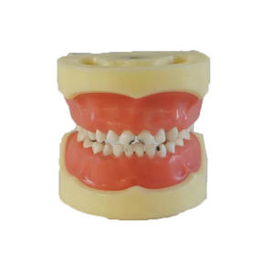 แบบจำลองฟันผุเด็กแบบพลาสติกขั้นสูง สำหรับการศึกษาทางการแพทย์และวิทยาศาสตร์กายวิภาค - Product Image 1