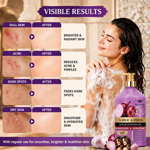 Gel Douche Exfoliant et Hydratant YuMeng à l'<span class=keywords><strong>Ail</strong></span> et à l'Oignon 1000ml – Nourrissant, Réparateur, Exfoliant – Lavant Corporel OEM Marque Privée - Product Image 4