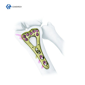 <span class=keywords><strong>Distal</strong></span> Radius Kilitleme Plakası - Değişken Açılı (VA) Titanyum LCP Plakası, Travma Cerrahisinde Bilek Kırığı Fiksasyonu için - Product Image 2