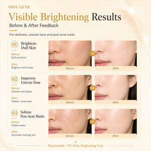 Sérum en gros à la Niacinamide et Vitamine C, Acide Hyaluronique, <span class=keywords><strong>Correcteur</strong></span> de Taches Brunes, Unifiant le Teint, Resserre les Pores, Traitement Facial - Product Image 4