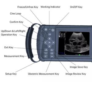 Échographe portable noir et <span class=keywords><strong>blanc</strong></span> économique pour usage médical et vétérinaire - Product Image 3