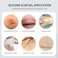 Pansements transparents en gel de silicone du fabricant chinois OEM pour le traitement des cicatrices chéloïdes