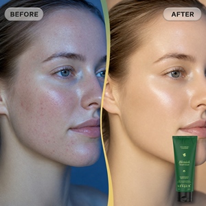 <span class=keywords><strong>CICA</strong></span> Skincare Coreano, Crema Coreana para el Cuidado de <span class=keywords><strong>la</strong></span> Piel, Control de Grasa, Anti-Acné, Reparación de Imperfecciones, Hidratante - Product Image 5