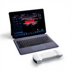 Sunbright VET Wireless USB Linear/Convex/Phased Array Probe Pocket VET Color <span class=keywords><strong>Doppler</strong></span> <span class=keywords><strong>Ultrasound</strong></span> <span class=keywords><strong>Scanner</strong></span> - Product Image 1