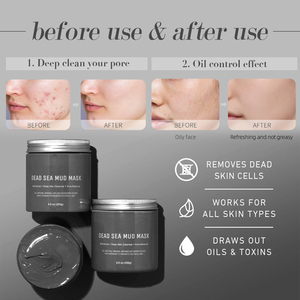 Lodo de limpieza Facial con ácido hialurónico antienvejecimiento ARTMISS, Etiqueta Privada, nutritivo, hidratante, arcilla negra del Mar Muerto, cara magnética - Product Image 5