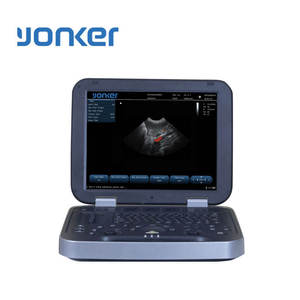 Ecógrafo Veterinario Portátil Doppler a Color para Hospitales de Animales Pequeños - Product Image 6