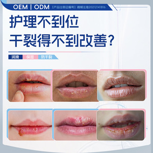 Apósito hidratante de polietilenglicol médico OEM/ODM de 15 ml para el cuidado de labios con cheilitis y protección de heridas - Product Image 4