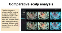 2025 Multi Functional Intelligent Hair and Scalp Analyzer Detector Device with Ai Medical Grade Portable Hair Care Machine