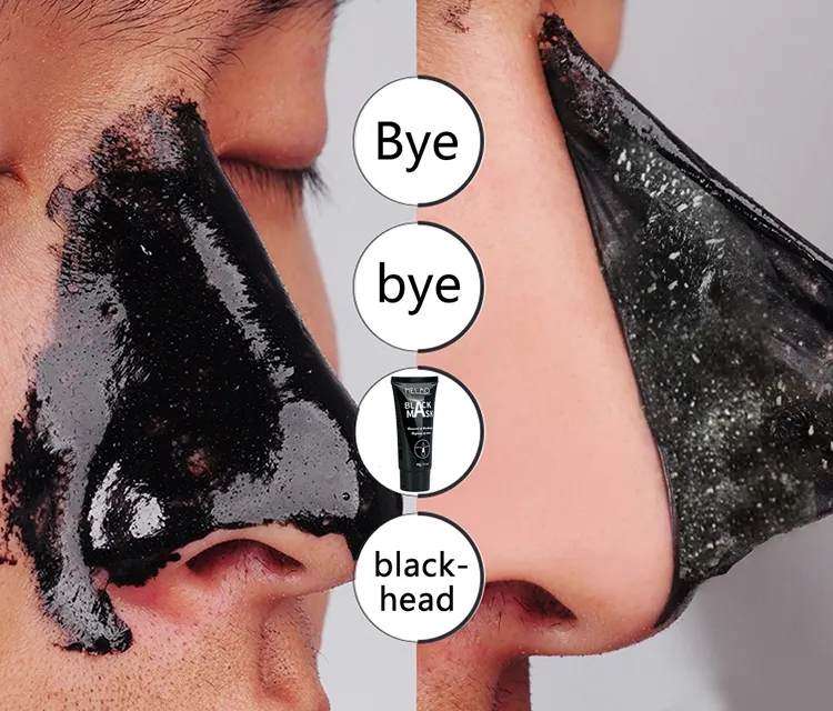 MELAO özel Logo derin yüz temizleme siyah kafa kaldırmak burun akne gözenek yüz cilt bakımı arındırıcı siyah nokta Remover maske krem
