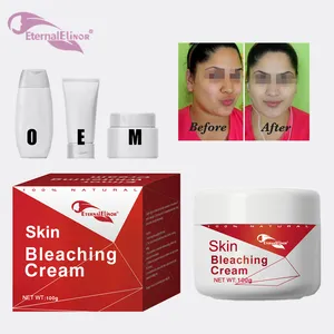 बड़ी छूट काले अंधेरे त्वचा बच्चे का चेहरा शरीर विरंजन तेजी से Whitening लोशन क्रीम निजी लेबल