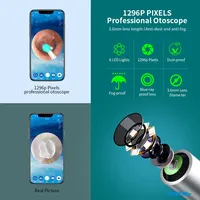 Kit de Nettoyage d'Oreilles Intelligent avec Caméra LED Portable Sans Fil, Otoscope WiFi, Outil Électrique Visuel pour l'Élimination du Cérumen