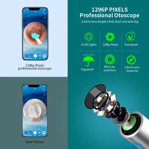 Smart LED Light Portable Wireless <strong>Ear</strong> Cleaner Camera Wifi Otoscope <strong>Ear</strong> Wax Removal Tool Electric Visual <strong>Ear</strong> <strong>Cleaning</strong> Device <strong>Kit</strong> - Product Image 3