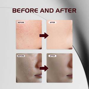 Individuelles Logo Koreanisches Glow Glass Skin Dunkle Flecken Entfernung Reines Tonisierendes Serum Nikotinamid Tranexamsäure Hautpflege-Serum Mit Arbutin - Product Image 4
