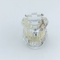 Implant dentaire détachable pathologique avec nerfs dent résine PVC pont couronne modèle de démonstration modèle de Construction