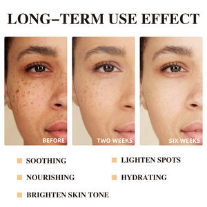 Set de Cuidado <span class=keywords><strong>Facial</strong></span> Más Vendido, Exfoliante, Antimanchas, Antiacné, Aclarante, Blanqueador, con Vitamina C y Cúrcuma, Set de Viaje para el Cuidado de la <span class=keywords><strong>Piel</strong></span> - Product Image 3