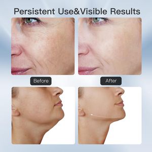 Shomfres nhà máy liệu pháp ánh sáng đỏ cho mặt và cổ Microcurrent mặt massager Da Thắt chặt thiết bị OEM/ODM Thiết bị chăm sóc da - Product Image 5