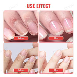 Crème de secours <span class=keywords><strong>pour</strong></span> cuticules | Mains, coudes et pieds secs et craquelés | Beurre de karité et huile de jojoba | Réparation et croissance des ongles, Vegan - Product Image 6
