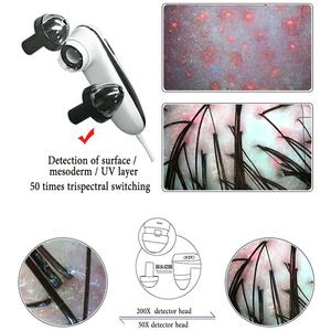 Analyseur de follicules pileux du cuir chevelu MEIBOYI avec connexion USB, compatible avec tablette ou téléphone Android, avec base de support portable, <span class=keywords><strong>pour</strong></span> une utilisation à domicile. - Product Image 5