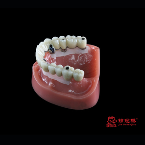 <span class=keywords><strong>Couronne</strong></span> <span class=keywords><strong>d</strong></span>'implantation en zircone personnalisée de laboratoire <span class=keywords><strong>dentaire</strong></span> Solution de restauration <span class=keywords><strong>dentaire</strong></span> rentable avec confortable et hygiénique - Product Image 3