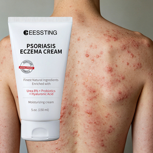 Crema de Alta Calidad para el Cuidado de la Piel Sensible con Problemas de Dermatitis, Psoriasis y Eccema, Nutritiva y Calmante - Product Image 1
