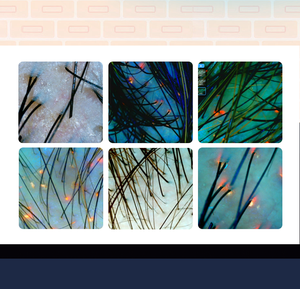 Analizzatore Professionale di Immagini Cutanee AI X5 Pro, Dispositivo di Rilevamento Facciale e del Cuoio Capelluto a Cinque <span class=keywords><strong>Dimensioni</strong></span>, Macchina per Test Microflora con Luce UV - Product Image 5