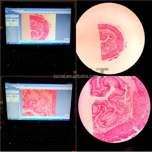 Nouvel adaptateur de caméra de microscope 0,5X, adaptateur C-Mount, interface de caméra CCD, adaptateur Photobube pour microscope <span class=keywords><strong>Olympus</strong></span> - Product Image 3