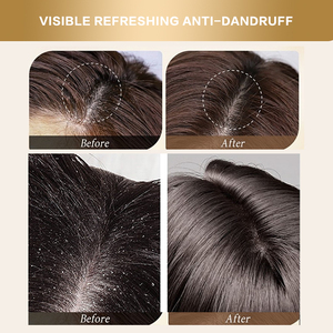 Shampooing antipelliculaire et anti-démangeaisons à la vitamine C, hydratant en profondeur, best-seller de luxe, 500 ml, adapté à tous les types de cheveux - Product Image 5