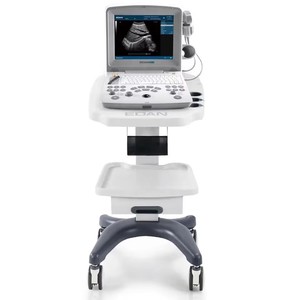 Máquina de Ultrasonido Veterinaria Edan DUS 60, Precio de la Máquina de Ultrasonido Veterinaria DUS60, Ultrasonido Portátil Veterinario en Blanco y Negro - Product Image 1