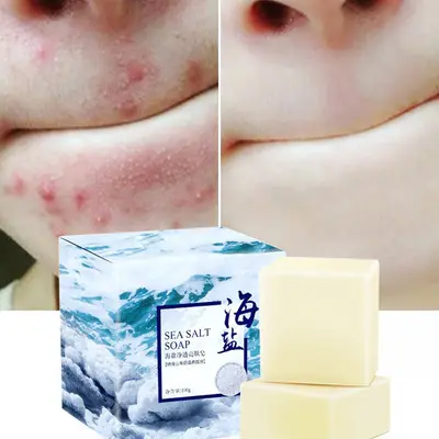 Melk Whitening Kruiden Zeep Acne Gluta Collageen Gezichtsverzorging Bad Wassen Basis Zeep Zee Zout Verwijdering Puistje Poriën Acne Behandeling geit