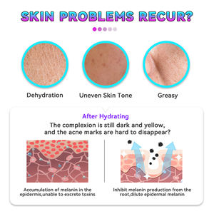 <span class=keywords><strong>Dr</strong></span>. Roseva Huidverzorging Van Gezichtsreiniger Sulfaatvrije Olie Controle & Anti-Acne En Aloë Vera & Slak Gezicht Wassen Voor Alle Huid - Product Image 5