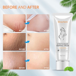 Crème anti-vergetures halal, crème pour éliminer les vergetures, traitement des vergetures - Product Image 4