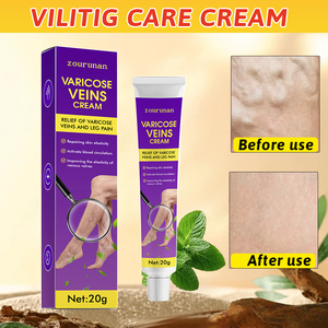 Crème Zourunan pour Varices – Pommade Confort pour l'Apparence des <span class=keywords><strong>Jambes</strong></span> 20g Tube Violet – Soin Externe Herbal Quotidien pour le Soutien des <span class=keywords><strong>Jambes</strong></span> – Vente en Gros - Product Image 3